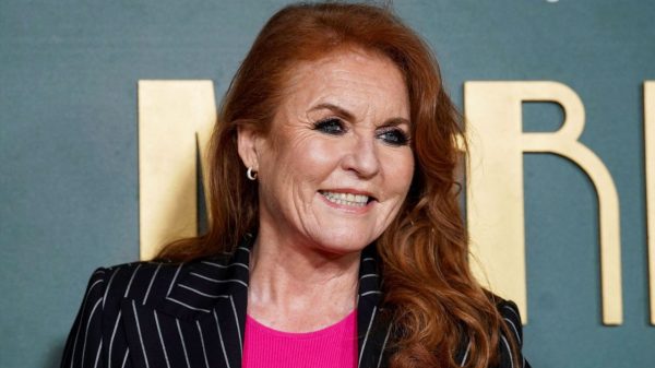 Sarah Ferguson skin cancer