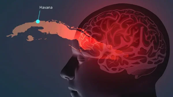 NIH failed to find evidence of brain injury due to Havana Syndrome